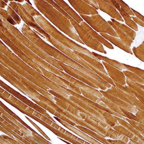 Actin (Muscle Specific)