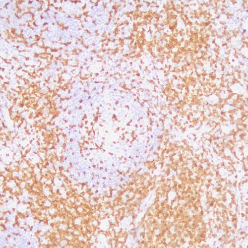 ZAP-70標記人扁桃體