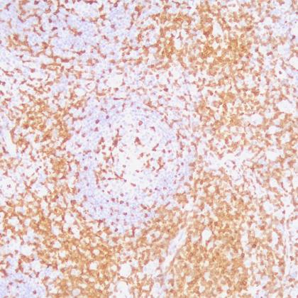 ZAP-70標(biāo)記人扁桃體